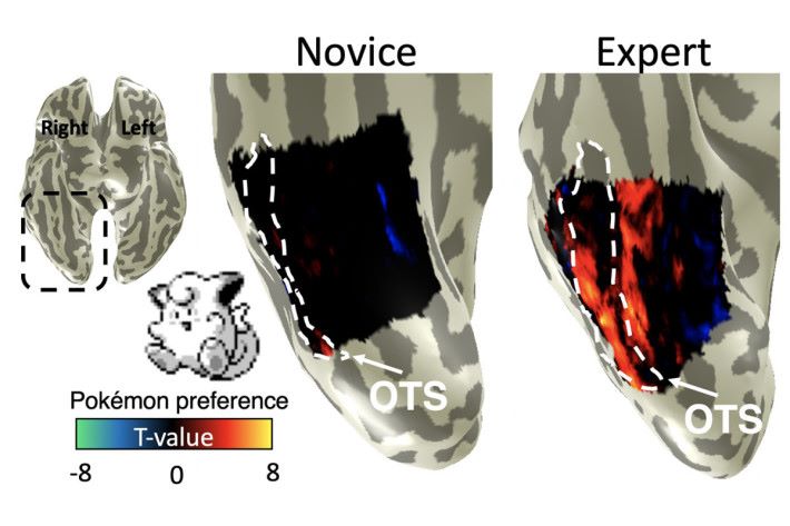 磁力共振掃描顯示，小時候玩 Pokémon 長大的人（右），大腦對小精靈圖像的反應，比沒有玩的人（左）明顯。